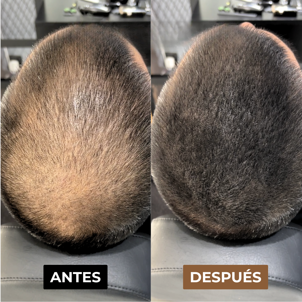 Camuflaje Capilar Solvera™
