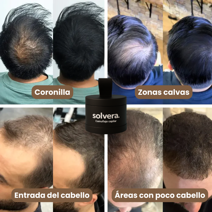 Camuflaje Capilar Solvera™